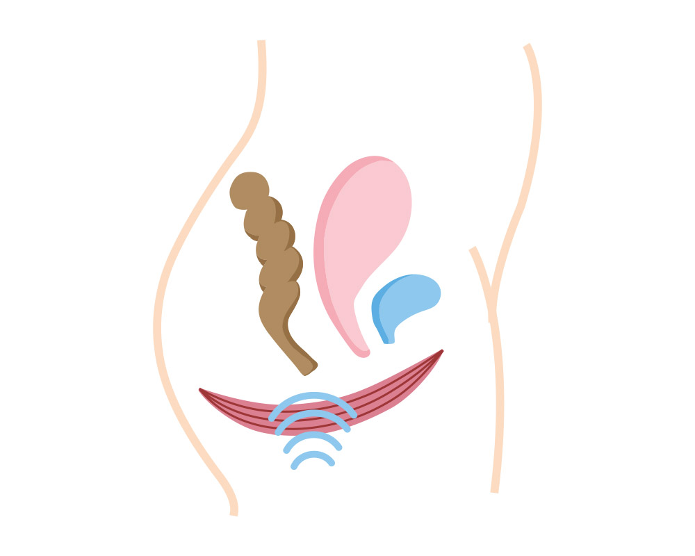 Schematische Darstellung der Beckenbodenstimulation während der Anwendung